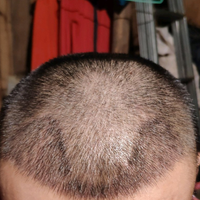 發(fā)際線(xiàn)用戶(hù)圖片