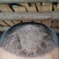 發(fā)際線(xiàn)用戶(hù)圖片