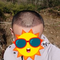 發(fā)際線用戶圖片