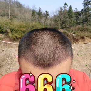 发际线分享社区