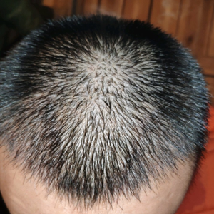 发际线分享社区