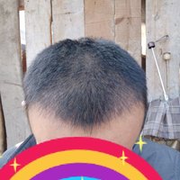 發(fā)際線用戶圖片