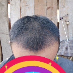 发际线分享社区