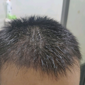 发际线分享社区