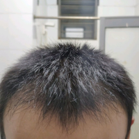 發(fā)際線用戶圖片