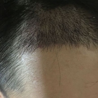 發(fā)際線用戶圖片