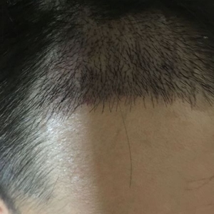 发际线分享社区