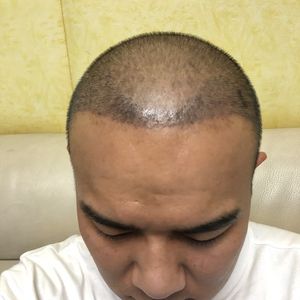 发际线分享社区