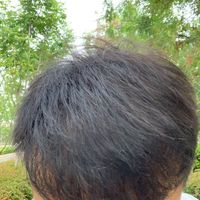 發(fā)際線用戶圖片