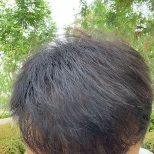 发际线分享社区