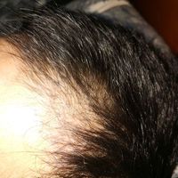 發(fā)際線用戶圖片