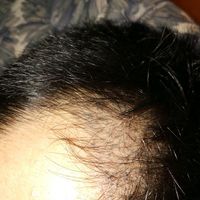 發(fā)際線用戶圖片