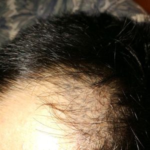 发际线分享社区