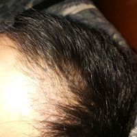 發(fā)際線用戶圖片