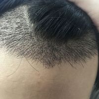 發(fā)際線用戶圖片
