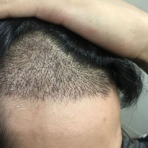 发际线分享社区