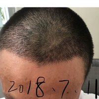 發(fā)際線用戶圖片