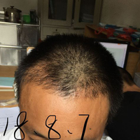 發(fā)際線用戶圖片