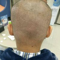 發(fā)際線用戶圖片