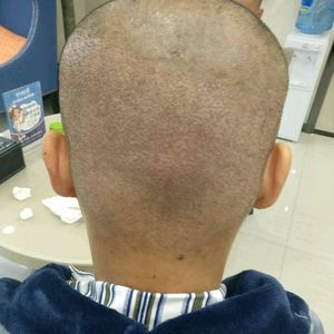 发际线分享社区