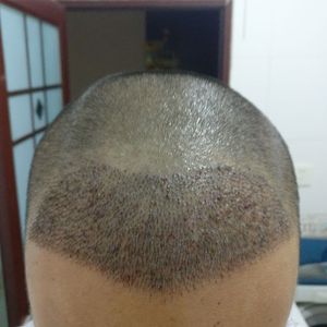 发际线分享社区