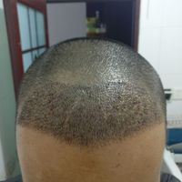發(fā)際線用戶圖片