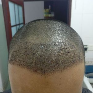 发际线分享社区