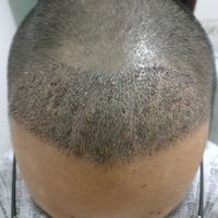 發(fā)際線用戶圖片