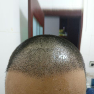 发际线分享社区