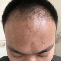 發(fā)際線用戶圖片