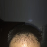 發(fā)際線用戶圖片