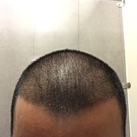 發(fā)際線用戶圖片