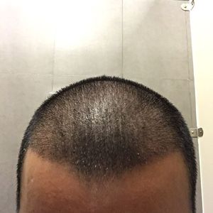 发际线分享社区