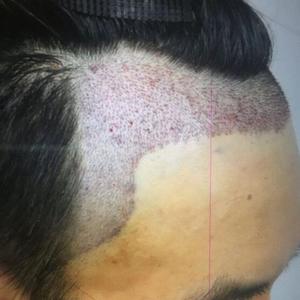 发际线分享社区