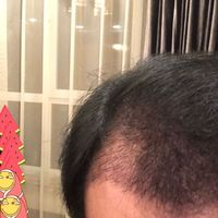 發(fā)際線用戶圖片