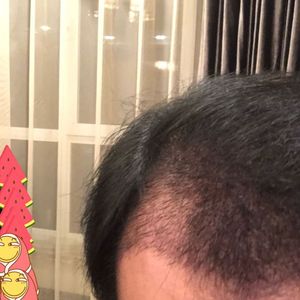 发际线分享社区