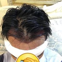 發(fā)際線用戶圖片
