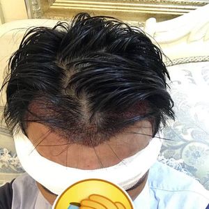 发际线分享社区