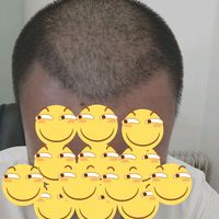 發(fā)際線用戶圖片