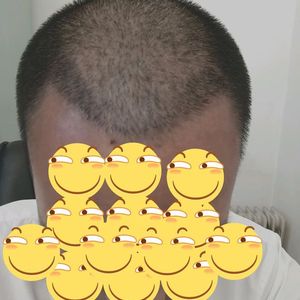 发际线分享社区
