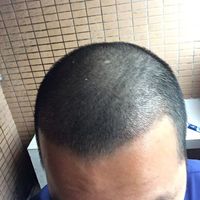 發(fā)際線用戶圖片