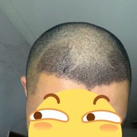 發(fā)際線用戶圖片
