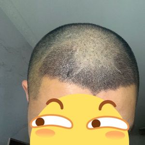 发际线分享社区