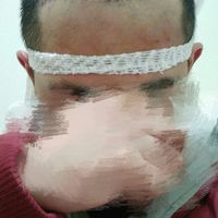 發(fā)際線用戶圖片