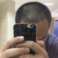 發(fā)際線用戶圖片