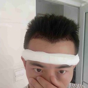 发际线分享社区