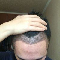 發(fā)際線用戶圖片