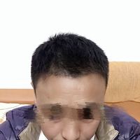發(fā)際線用戶圖片