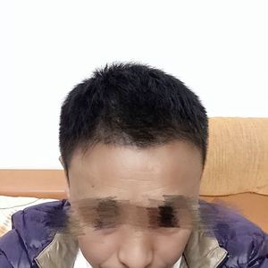 发际线分享社区