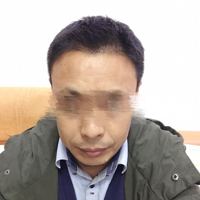 發(fā)際線用戶圖片